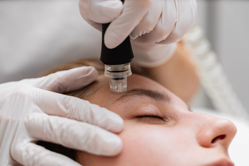 Close-up of a microdermabrasion device applied to a woman's forehead during a skincare session wearing protective gloves.