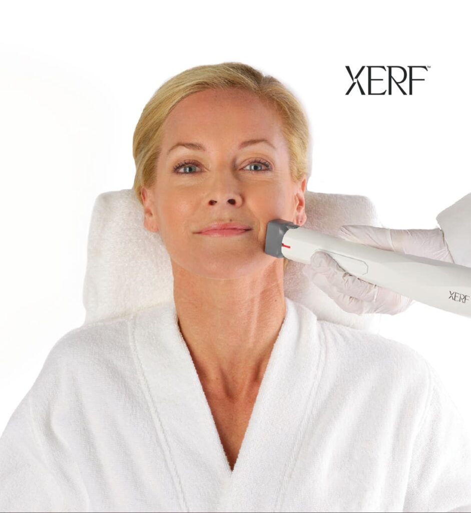 Woman receiving XERF treatment on her cheek during a maintenance visit for continued skin firmness.