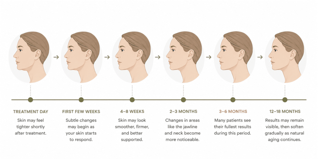 Six-stage timeline showing gradual improvement in facial skin firmness from treatment day through 12 to 18 months.